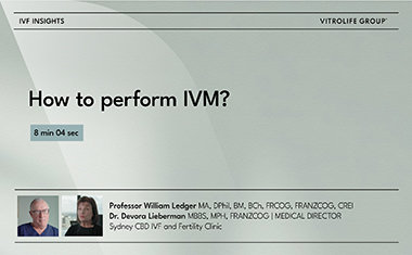 How to perform IVM?